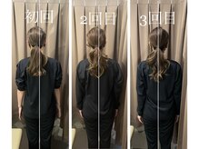 アイリー(Irie)/骨格矯正