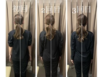 アイリー(Irie)/骨格矯正