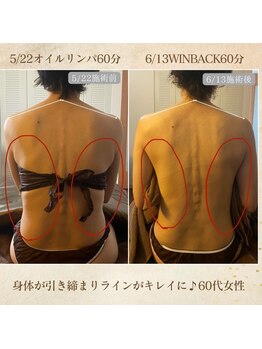 エソール(essor)/ぶよぶよお肉もスッキリ♪