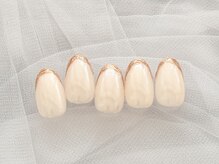 バイオ ナゴヤ(Bio nagoya)/フィルイン・パラジェル変更可