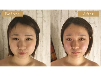 サンムーン/整体×ピラティス×小顔矯正