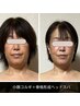 【黄金バランスがコルギで叶う☆小顔リフト】小顔コルギ＋ヘッドスパ(70分)