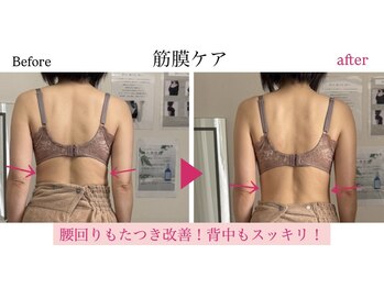 プティラボ(Petit Labo)/No1.筋膜ケアビフォーアフター！