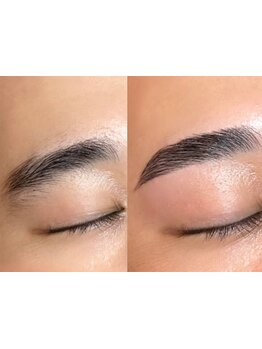 メンズフェイシャル