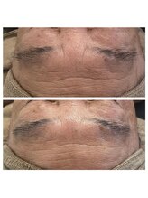 美温(mion)/ふわっと表情筋柔らかく