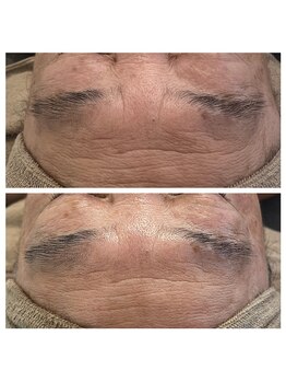 美温(mion)/ふわっと表情筋柔らかく