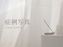 シーベル 新宿/ハーブピーリング症例写真