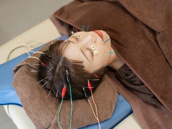 ウギィ(ugi-)の写真/急な身体の痛みや慢性的な痛み、身体のだるさを「鍼」で改善♪原因にしっかりアプローチする本格鍼灸。