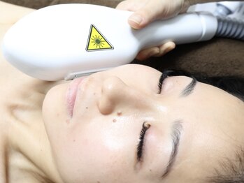 ムーン(Moon)の写真/【熟練の高技術◎】最新光フェイシャルで女性の肌悩みを短期間で改善！継続的な肌ケアで若々しい印象へ♪