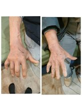 ストライクボディケア(STRIKE. BODY CARE)/☆浮腫みの解消