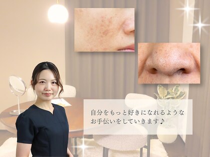 レイミー(reimee)の写真