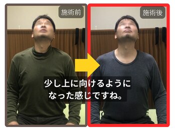 まこと整骨院/ずっと取れない長引く肩の痛み３
