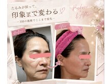 ケイ エムワン(K M1)の雰囲気(たるみが減って印象まで大きく変わります★)