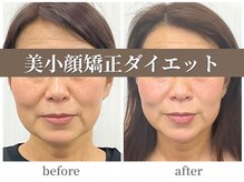 ステイゴールド美容整体院(STAY GOLD)の雰囲気（隠れて食いしばり・エラ張り特化プロ級の小顔矯正やってます◎）