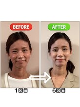 セントラル治療院はりきゅう大心/ビフォーアフター