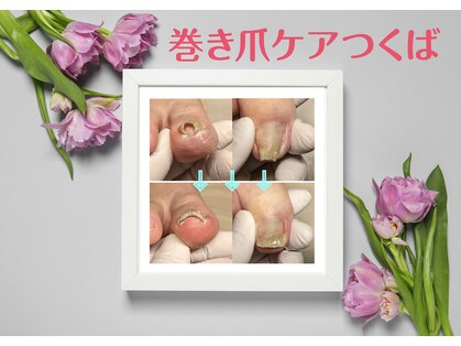 かとり台整骨院 つくばの写真