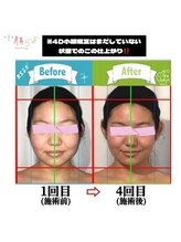 小顔整体研究所 KSラボ 新潟中山店/