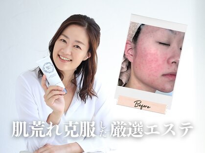 ビューティー ブロッサム(Beauty Blossom)の写真