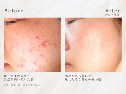 メレ(mele)の写真