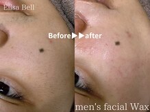 エリーザベル(Elisa Bell)/大人気のツヤ肌ワックス脱毛