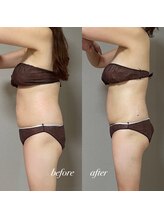 エヌボーテ(N. beaute)/before→after