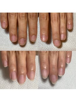 カンパニュラ(Campanula)/自爪育成