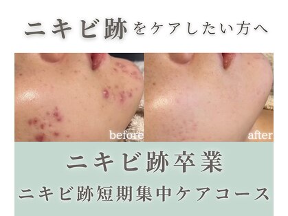 モニ 福岡(Moni)の写真