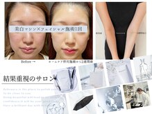 ビボーラ(BEBEAURA)
