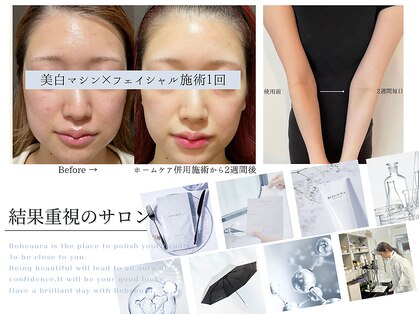 ビボーラ(BEBEAURA)の写真