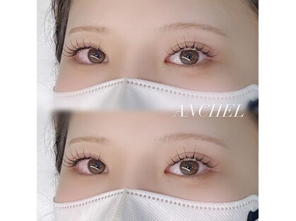 アンシェル(ANCHEL)の写真
