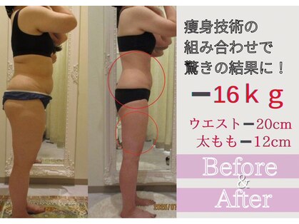 クリニカルエステ/イーズ 六甲アイランド店の写真