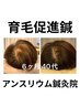 人目が気にならない【抜け毛ケア専用鍼】太く強く抜けにくく/カウンセリング