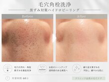 ネイキッド (NaKid)
