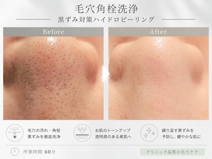 ネイキッド (NaKid)の写真