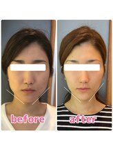 ヴィヴィアナ(viviana)/エラ撃退したい！