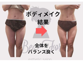 ビーフォー(be for)/30代　１０回コース結果