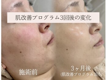 ラシュール(Rassure)