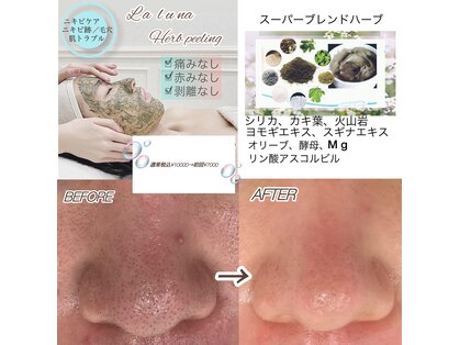 ラルーナ(La Luna)の写真