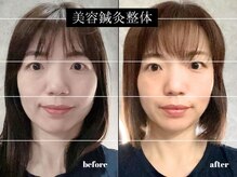 福多整体院の雰囲気（一回の効果はもちろん、継続する事でお顔の印象まで変化！）