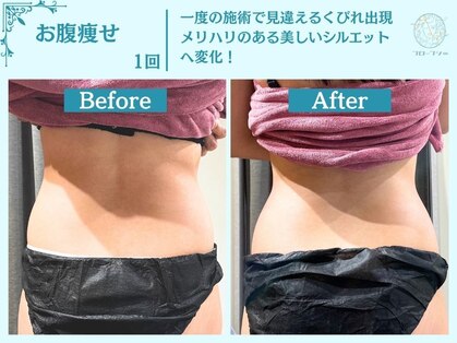 フローフシ∞の写真