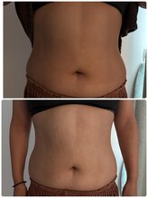 メディカルエステ ユウ(Yuu)/