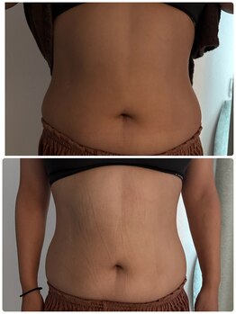 メディカルエステ ユウ(Yuu)/