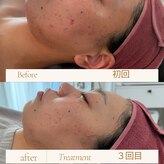 エム シャルール(M chaleur)