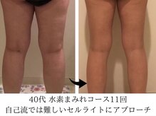 ヨサパーク タキ 上野毛(YOSA PARK TAKI)/40代・ダイエット卒業コース