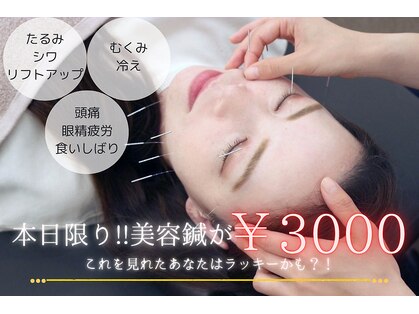 三国駅前ビューティー鍼灸院(三国駅前Beauty鍼灸院)の写真