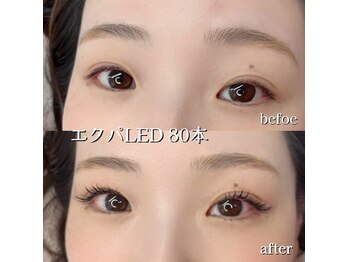 プリティアイ(pretty eye)/エクパで垢抜け！