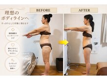 アリュールの雰囲気（50代、５９キロから４6キロへ激変。3ケ月12回で腹囲－15センチ　）