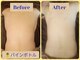 サロンド ベレーゼの写真/今話題のパインボトルで脂肪縮小ケアをして体のくびれや二の腕、足、フェイシャルなど２0分かけてひきしめ