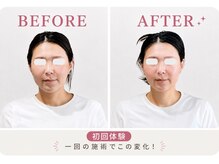 リフェイス(RE:FACE)の雰囲気（小顔コルギでフェイスラインすっきり♪）