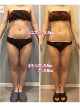 サロン ド フェイス モアナ(Salon de Faith Moana)/キャビテーション痩身